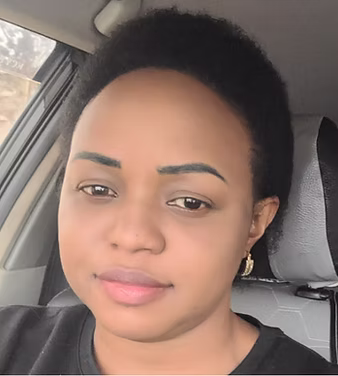 After hairline restoration